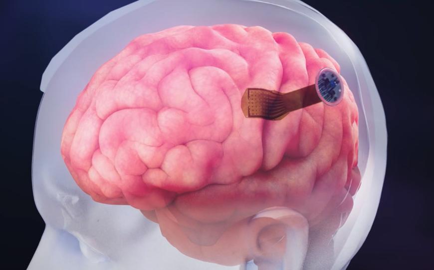 “大脑第7层”获FDA突破性设备认证，公司同日宣布收购制造工厂